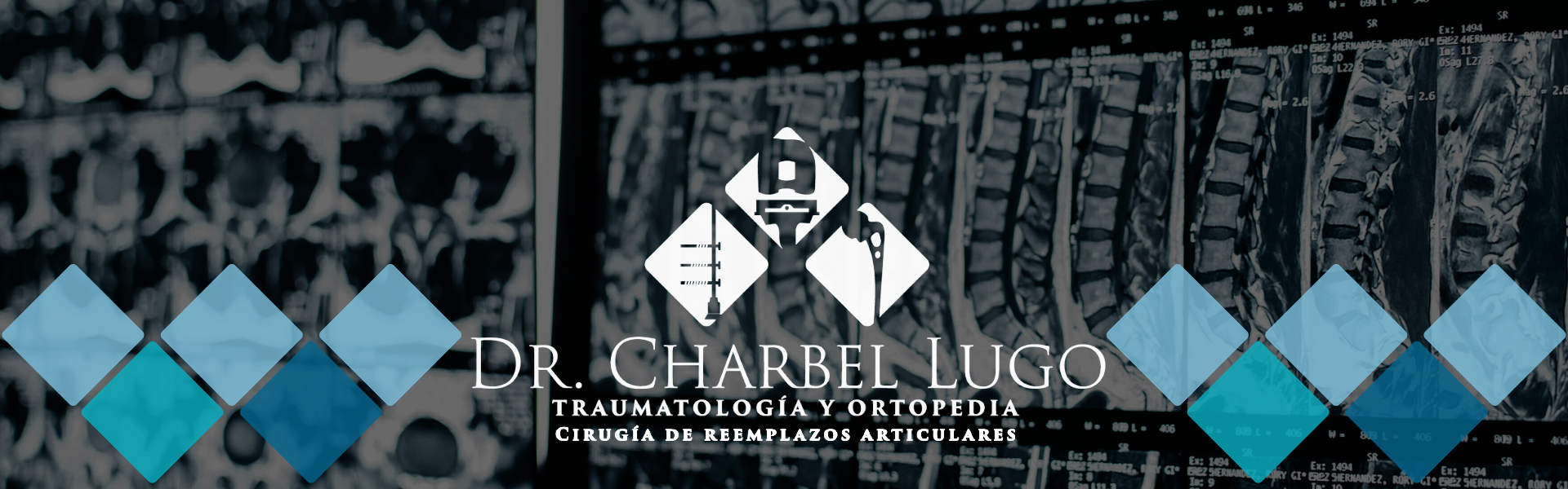 Cirugía de reemplazos articulares: Dr. Charbel